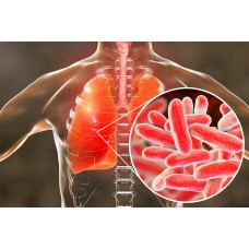 Prevencia legionelly v domácnosti